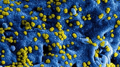 hantavirus referencia