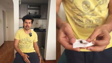 Dispararon al Youtuber Diego Andariego durante un intento de robo en Bogotá