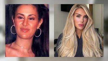 Ninel Conde sorprende con su nuevo rostro a los 50 años: “Ya no eres Ninel”