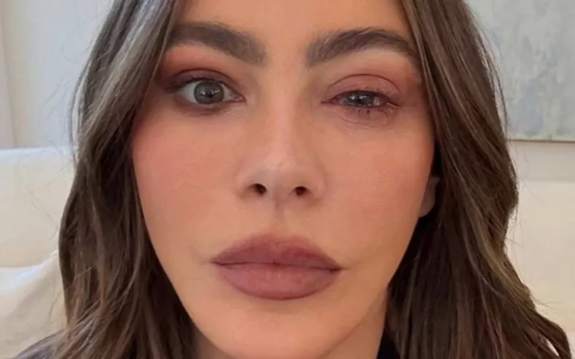 Sofía Vergara sufrió una reacción alérgica en sus ojos
