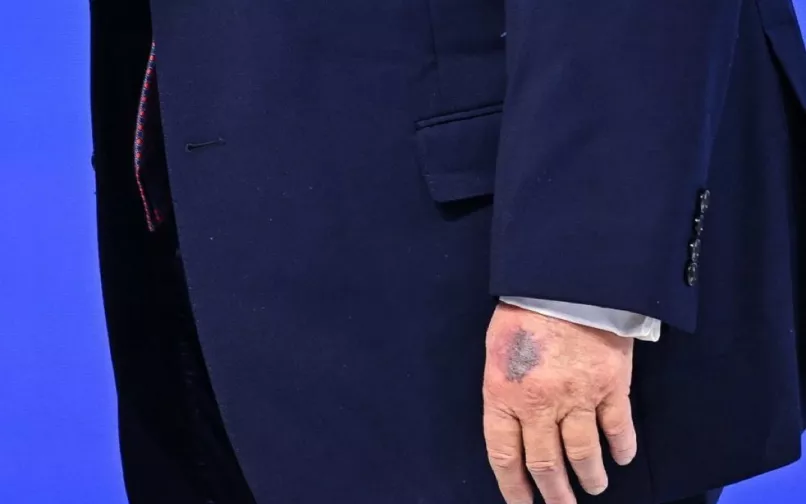 Detalle de la mano de Donald Trump