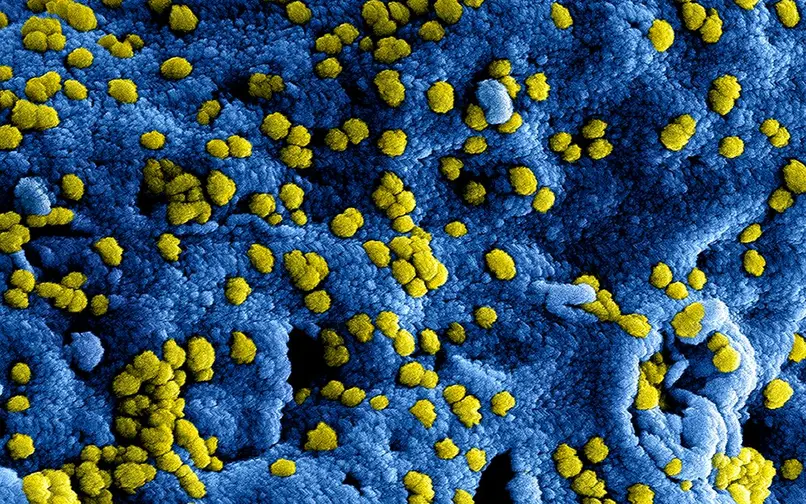 hantavirus referencia