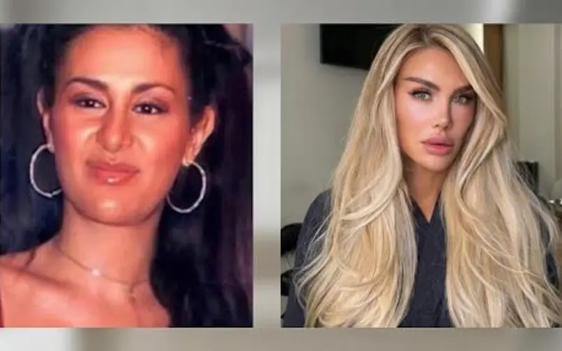 Ninel Conde sorprende con su nuevo rostro a los 50 años: “Ya no eres Ninel”