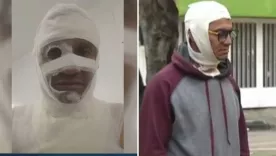 Hombre atacado con ácido en Bogotá