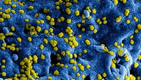 hantavirus referencia