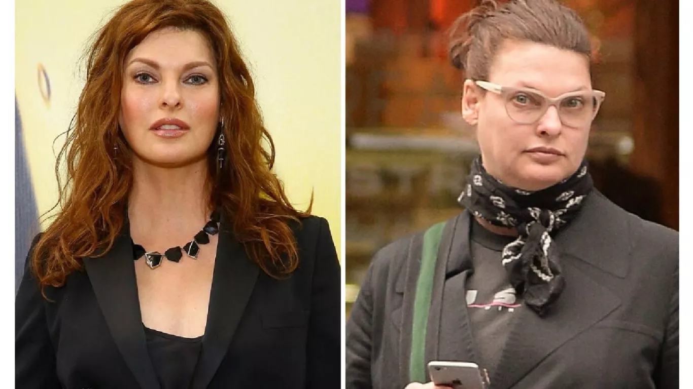 En Colombia se ofrece procedimiento cosmético que desfiguró a Linda Evangelista, ícono de la moda