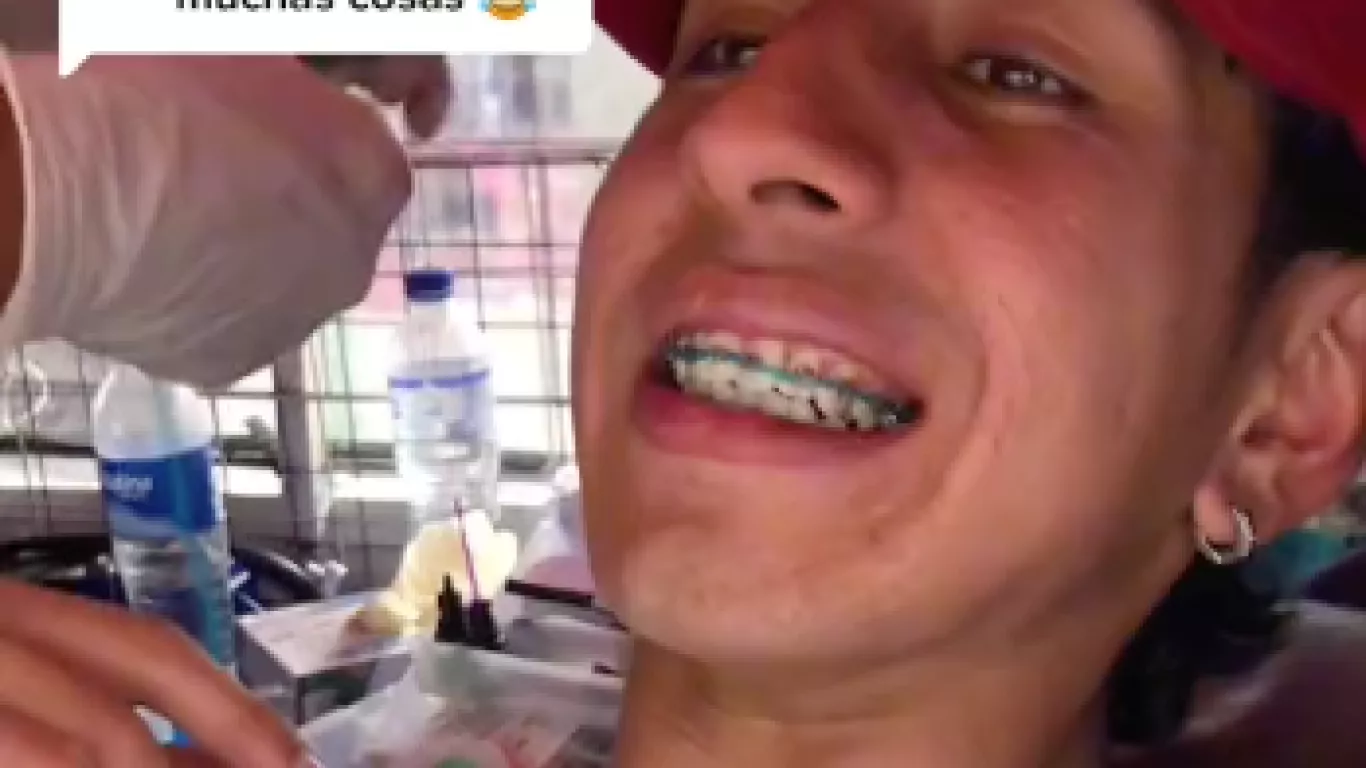 Apareció otro sitio donde ponen Brackets a $100.000 en Bogotá