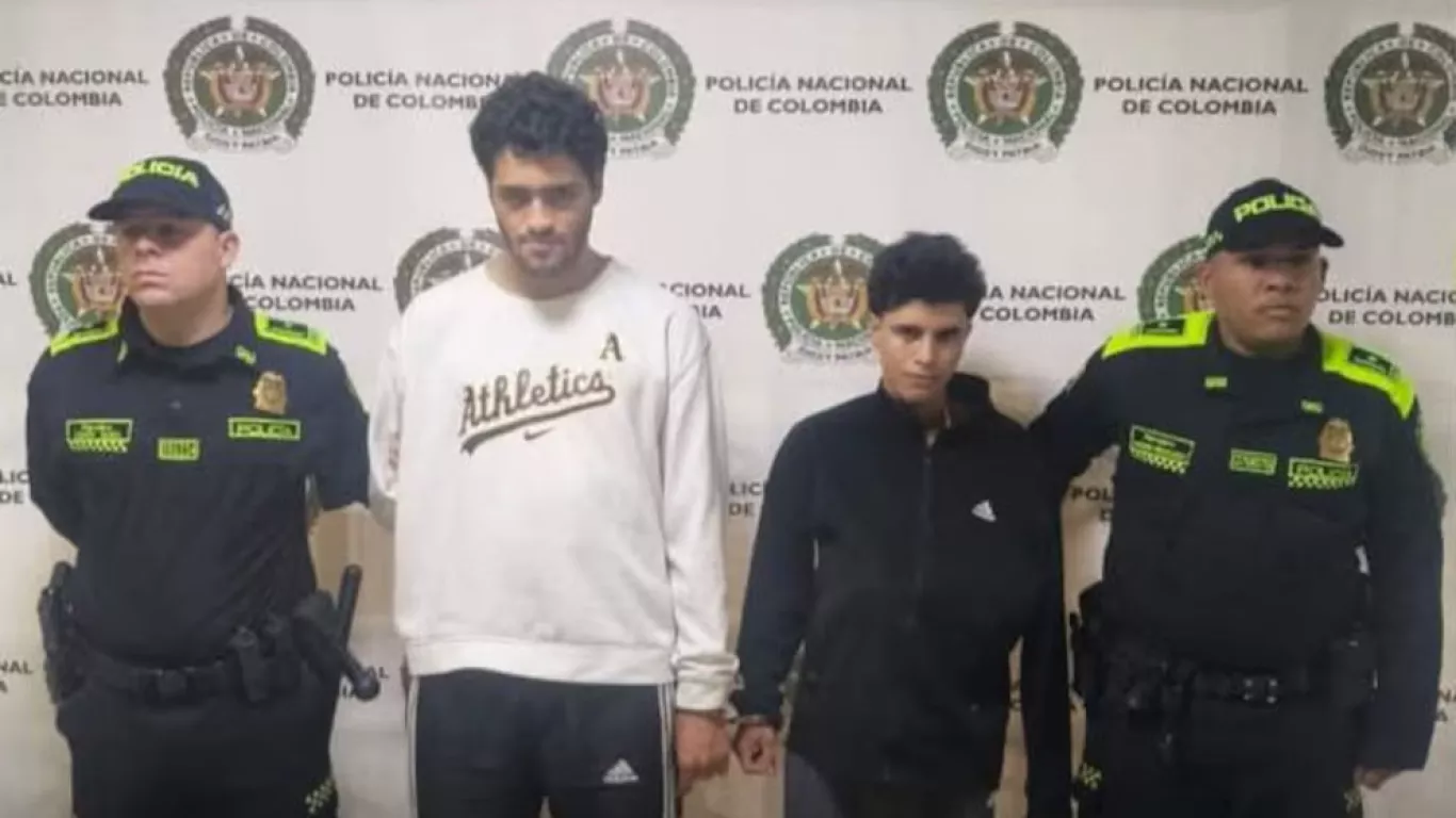 alias mandibula y aretes