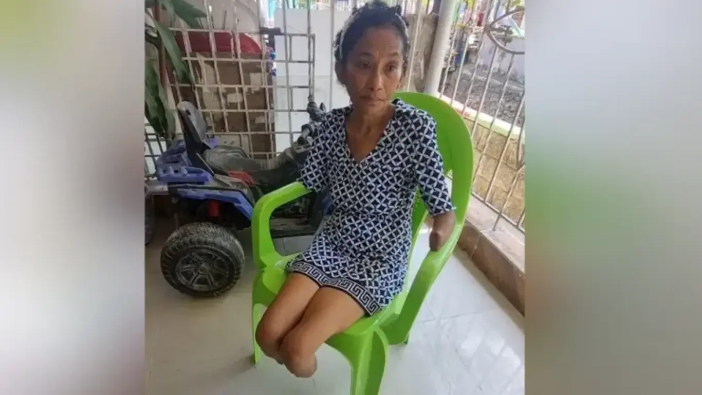 Fue a la clínica por fiebre y terminó con amputación