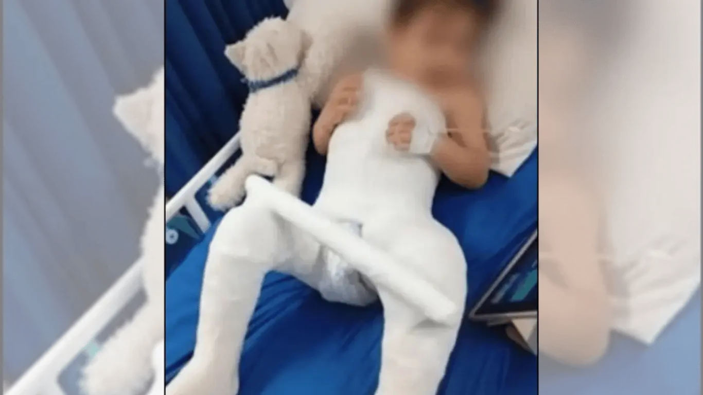 Niño de dos años con fractura 