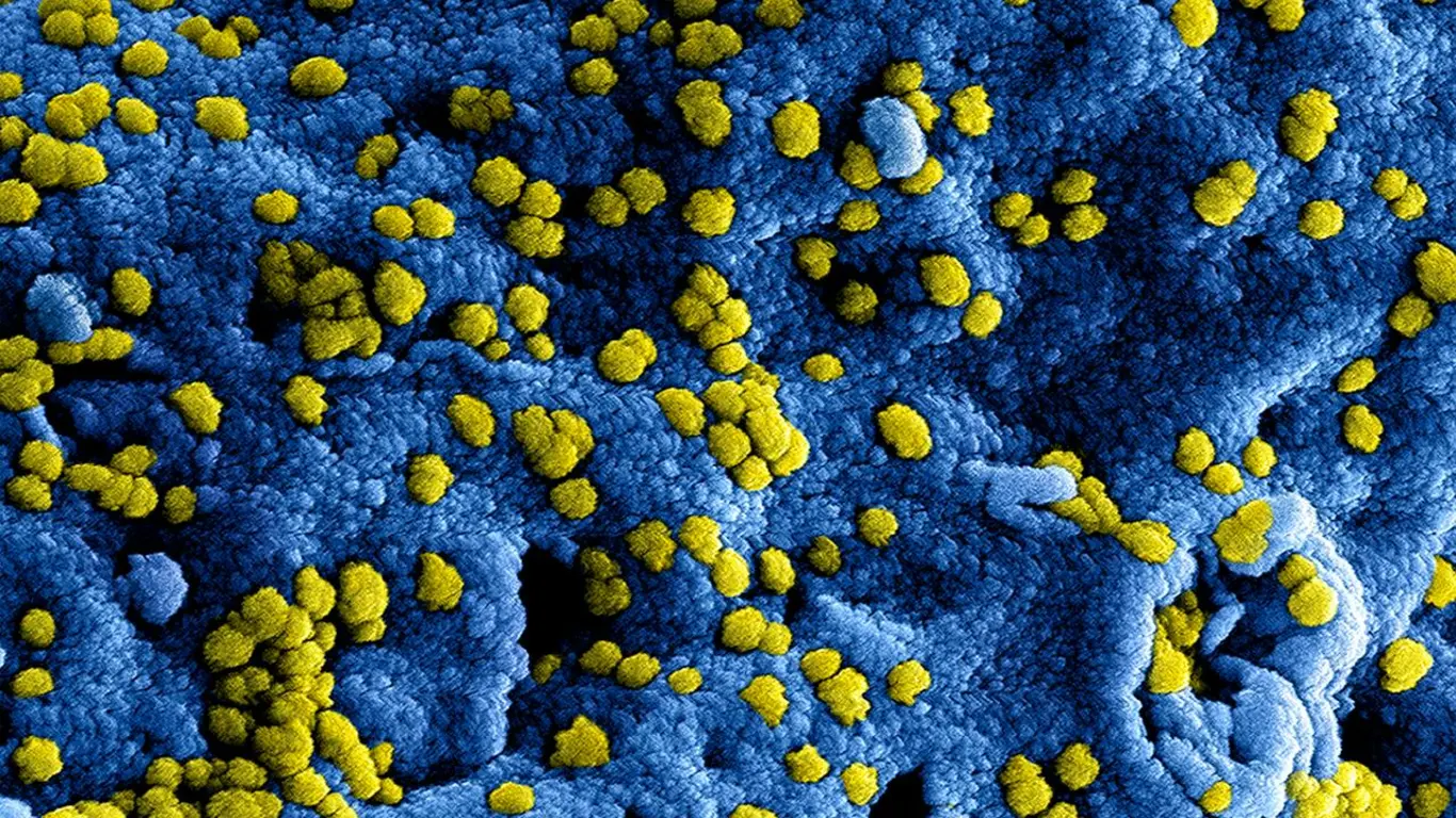 hantavirus referencia
