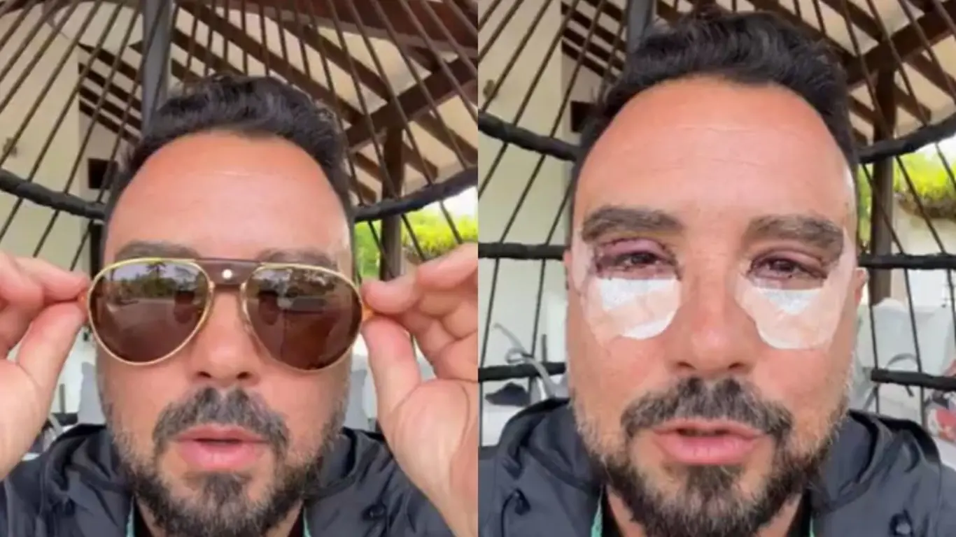 Tulio Zuloaga se sometió a una blefaroplastia