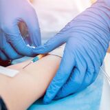 Paciente en tratamiento de quimioterapia