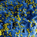 hantavirus referencia